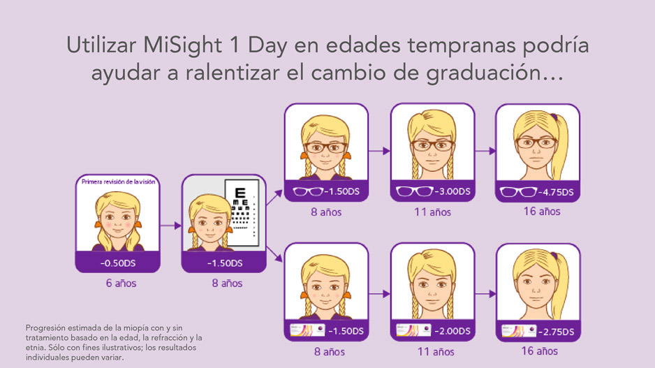 Comparación estimada de la progresión de la miopía en niños con MiSight® 1 Day